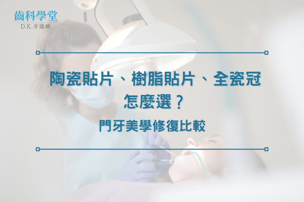 陶瓷貼片、樹脂貼片、全瓷冠怎麼選？門牙美學修復比較