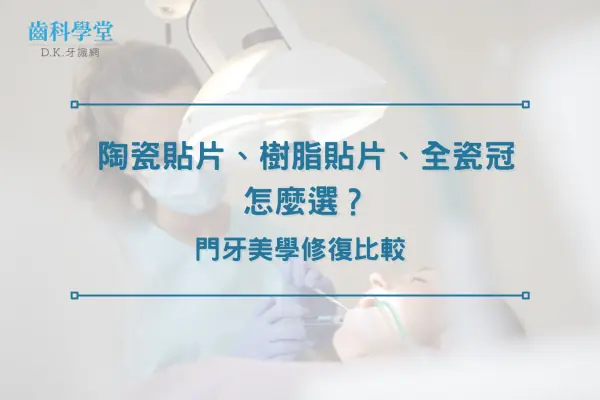 陶瓷貼片、樹脂貼片、全瓷冠怎麼選？門牙美學修復比較